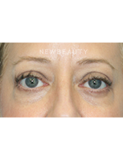 Dr. Christine Hamori - A Brighter Outlook - After