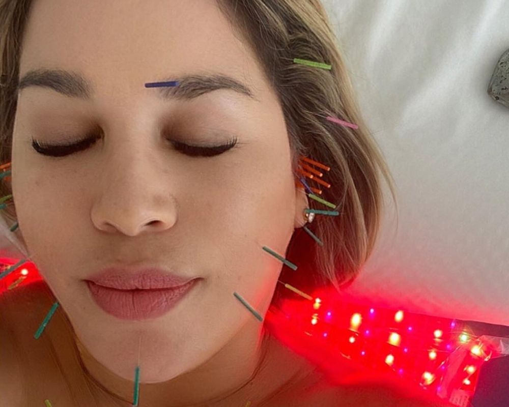 How This Acupuncture Treatment Can Help Recontour Your Face