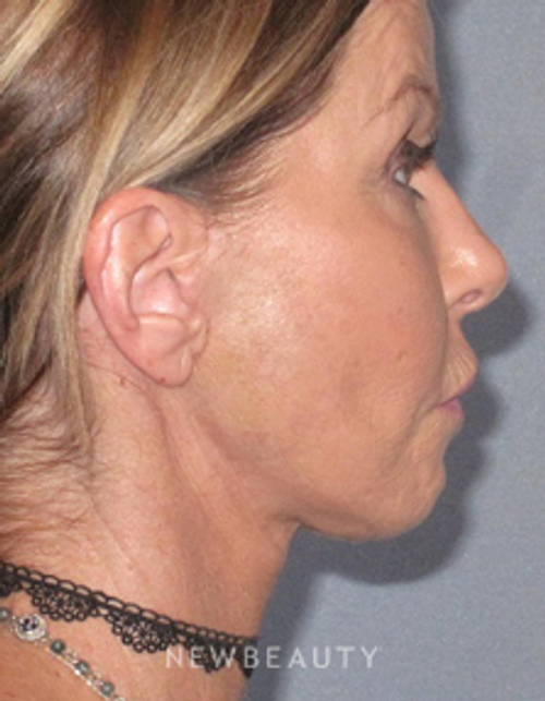 Dr. German Newall - Refreshed Look - After