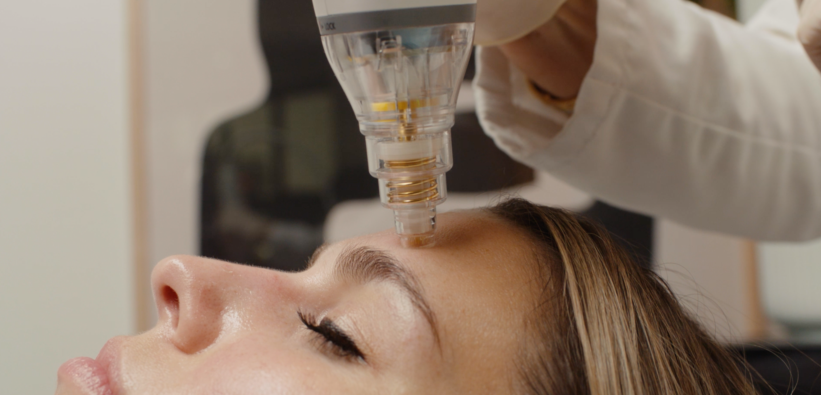 5 Things You Didn’t Know RF Microneedling Could Do For Your Skin