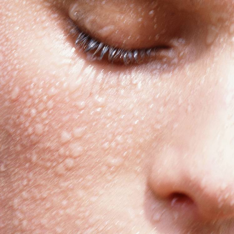 You're Seeing Uneven Texture