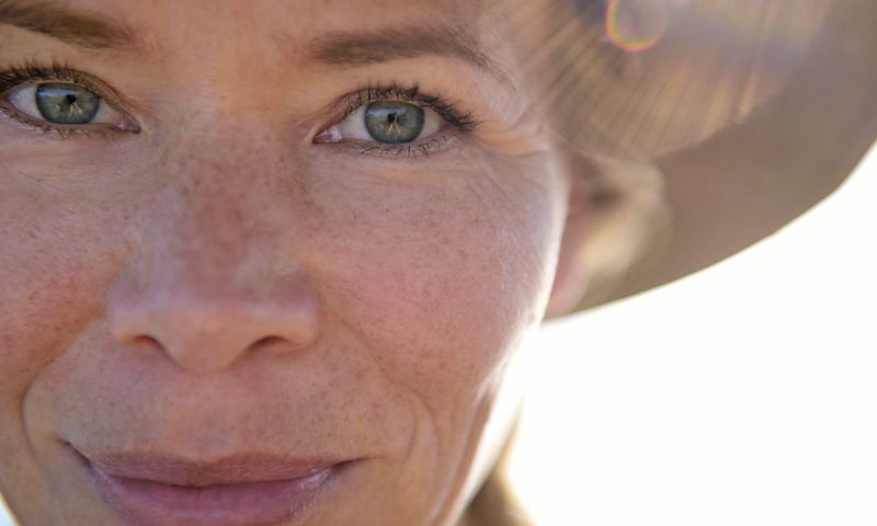 women over 50 skin issues