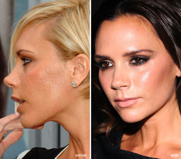 Victoria Beckham