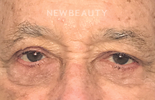 Dr. David Schlessinger - Turning Back the Clock - After