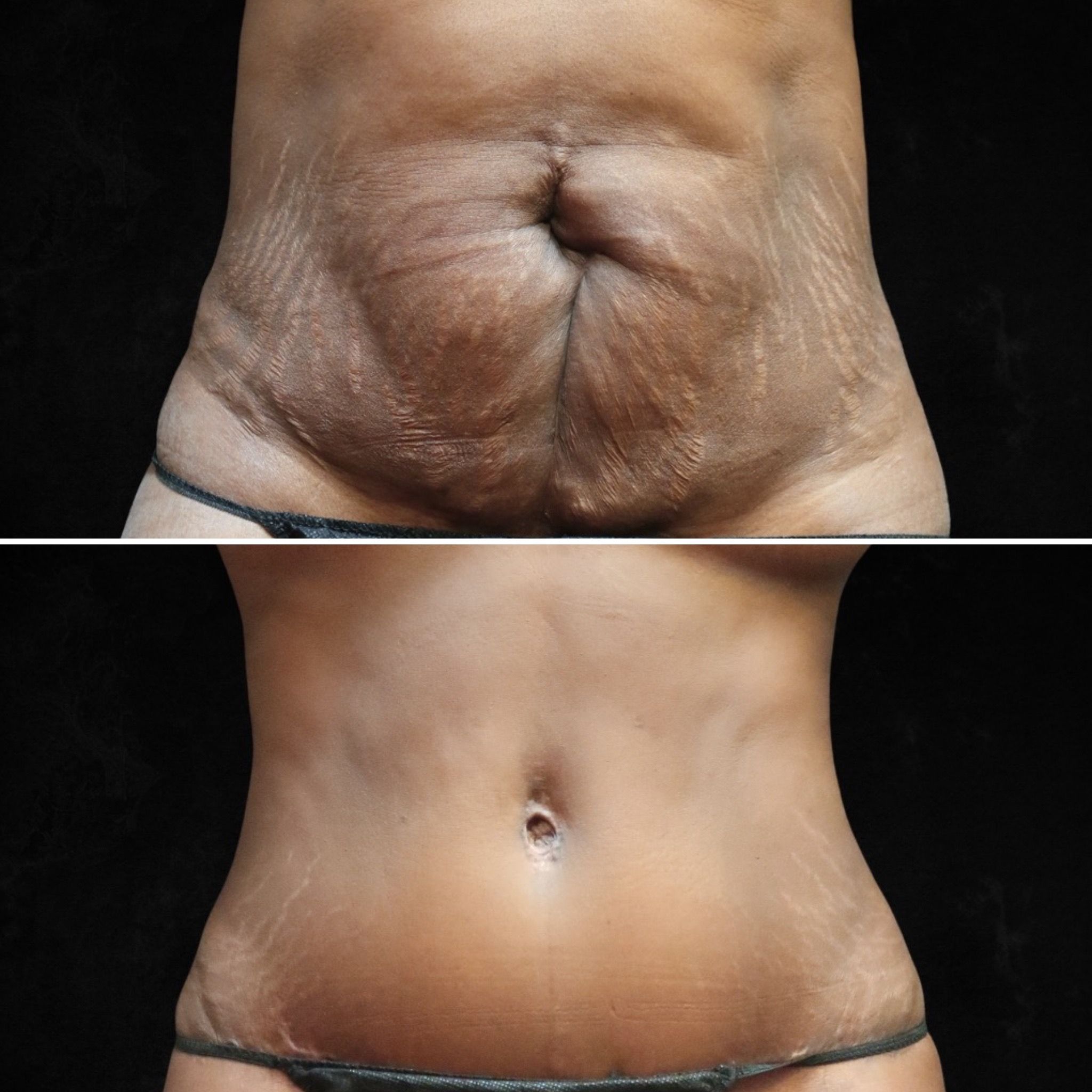 New York, NY plastic surgeon Elie Levine, MD