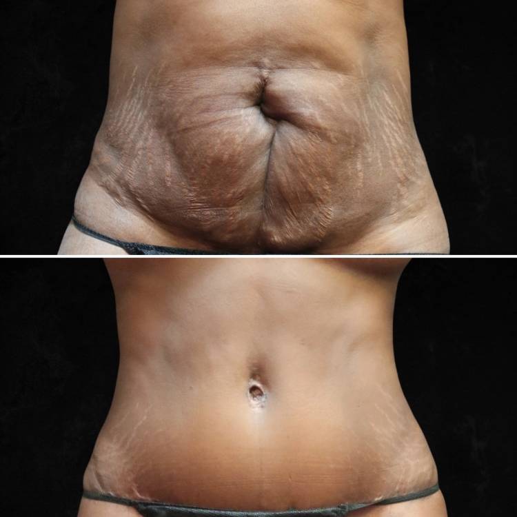 New York, NY plastic surgeon Elie Levine, MD