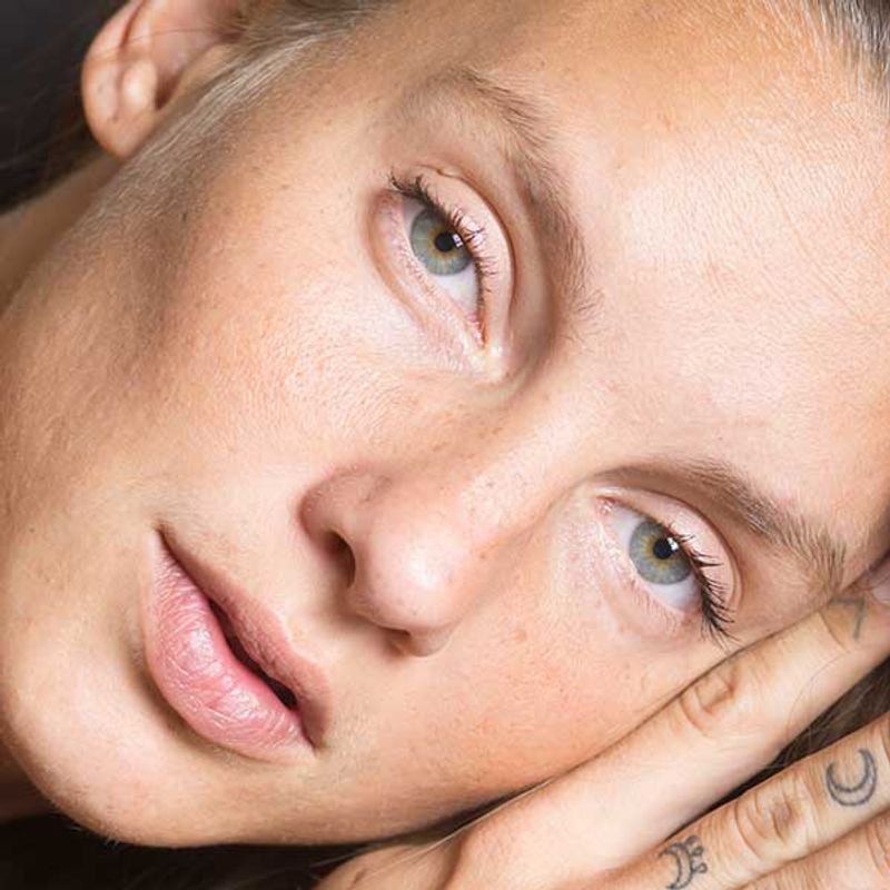 Galderma Restylane Eyelight