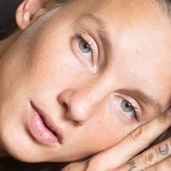 Best Filler for Under-Eye Hollows