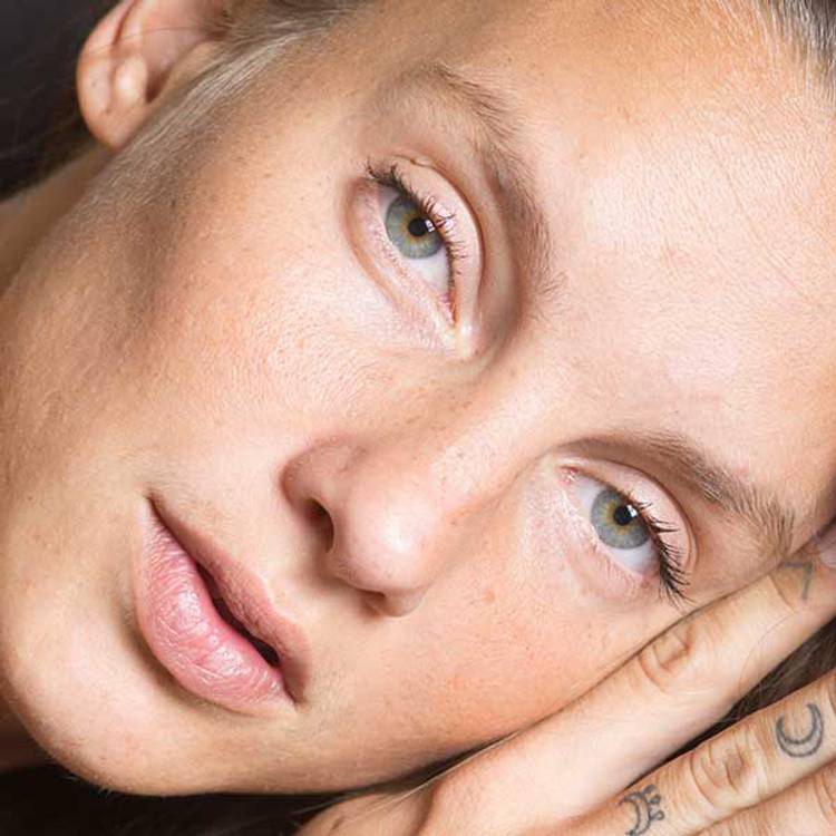 Best Filler for Under-Eye Hollows