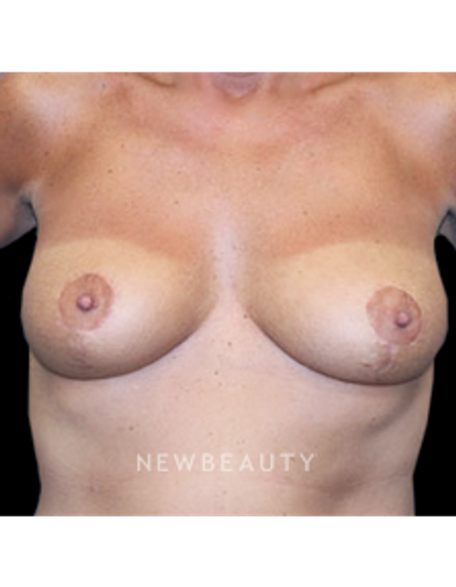 Dr. Christine Hamori - A Natural, Noticeable Change - After