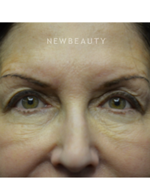 Dr. B. Aviva Preminger - Aging Gracefully - Before