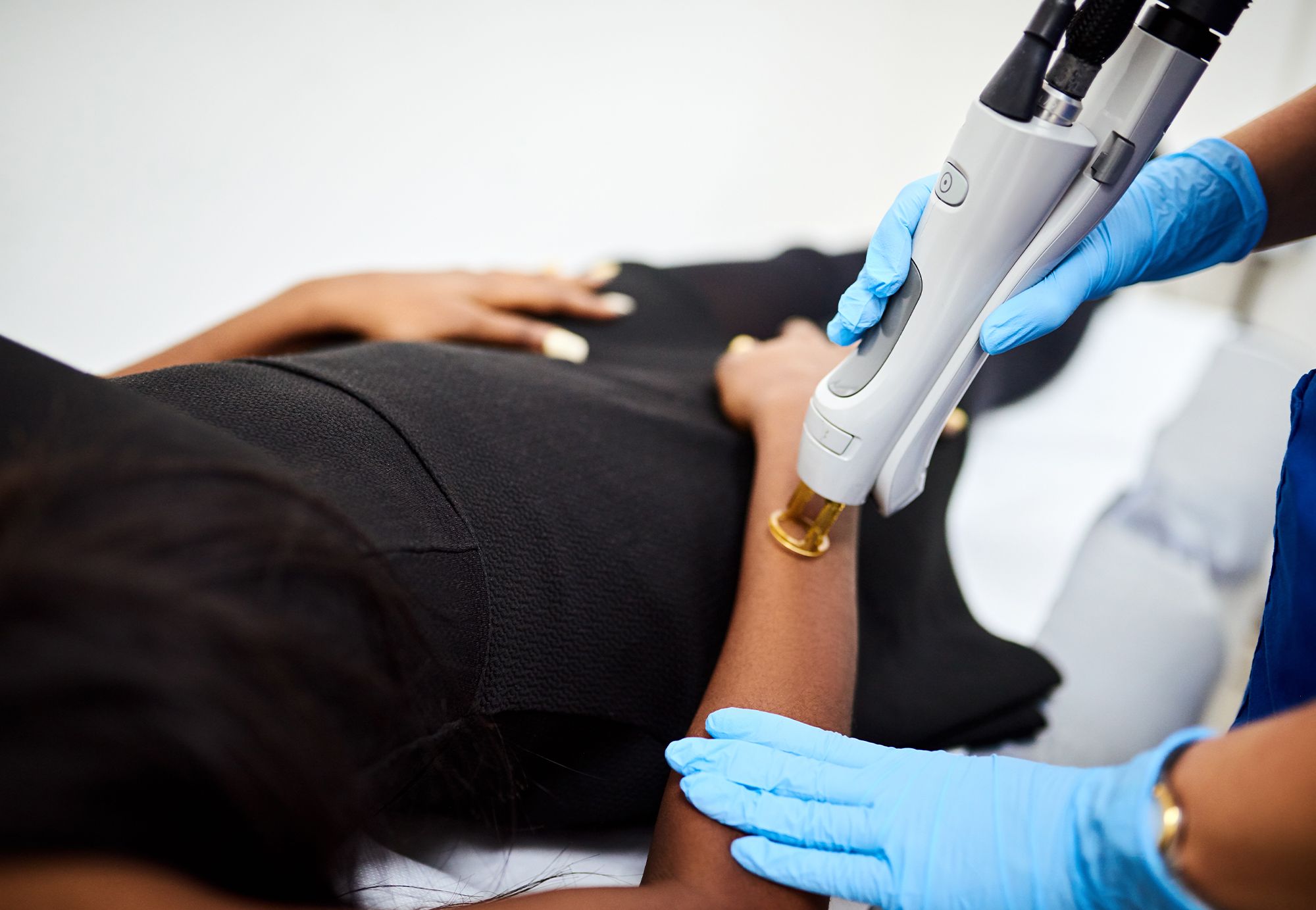 Dermatologist-Approved Scar Revision Treatments Options for Melanated Skin Tones