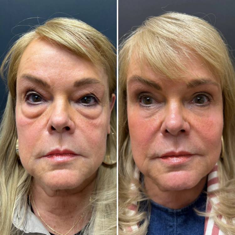 New York plastic surgeon Mokhtar Asaadi, MD