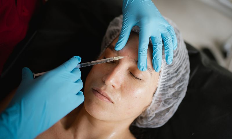 Doctor injecting botulinum toxin into a young woman's forehead, enhancing facial rejuvenation and addressing fine lines and wrinkles