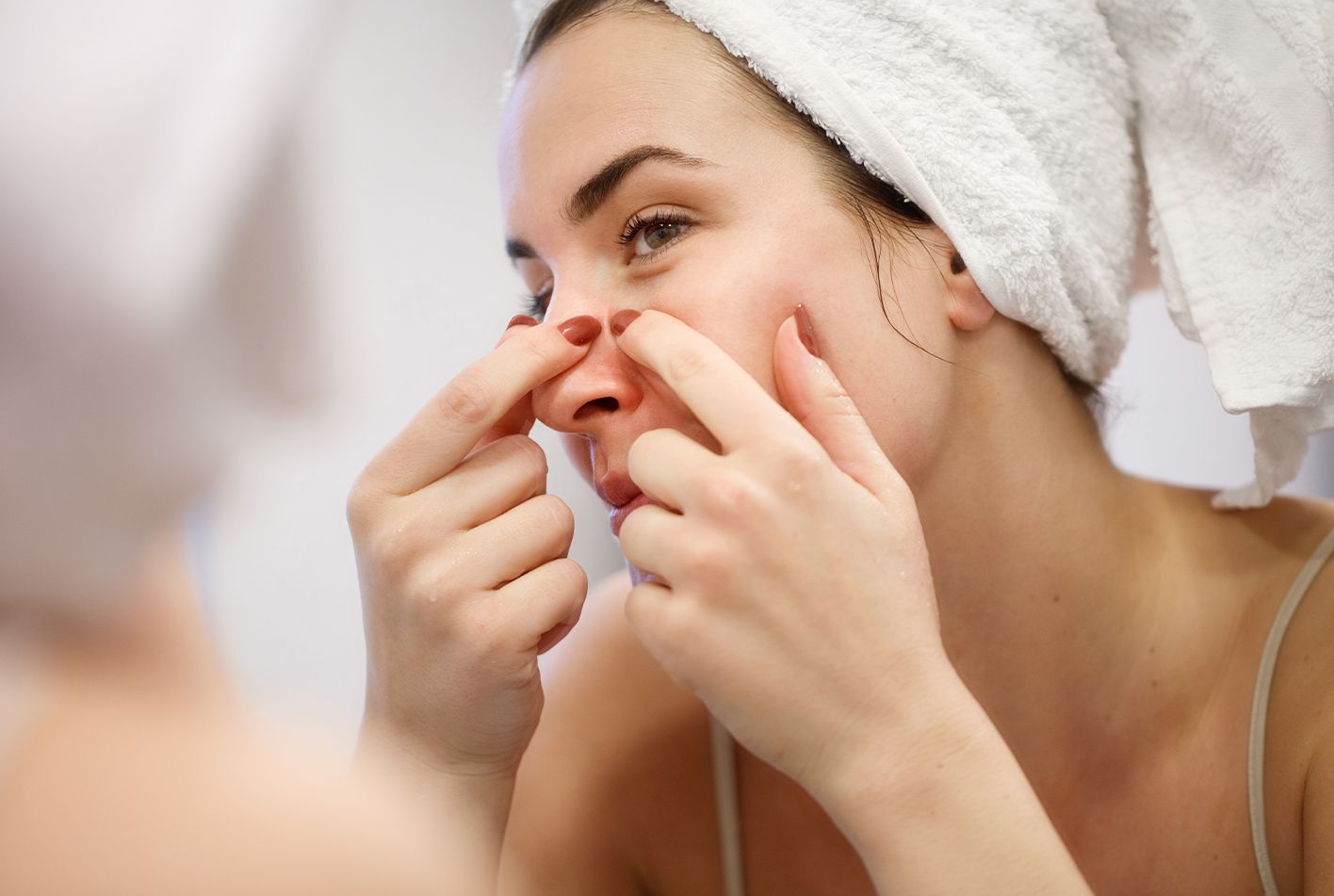 Should We Be Applying Iodine on Pimples?