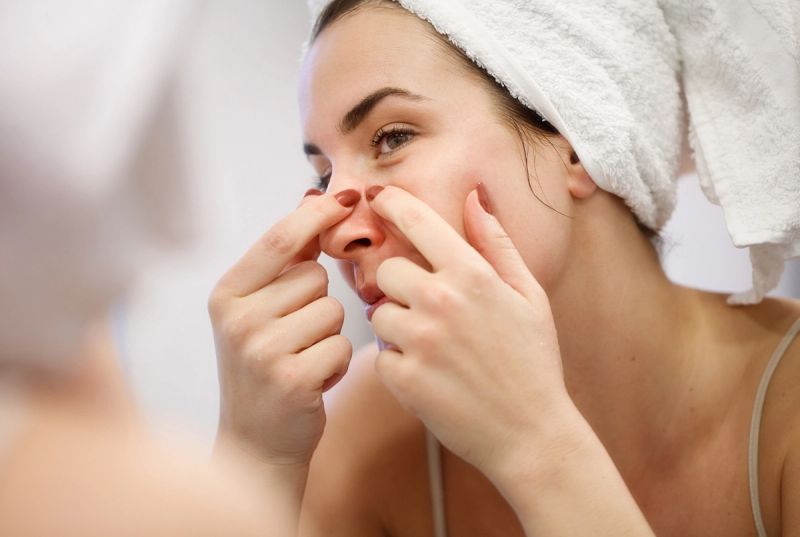 Should We Be Applying Iodine on Pimples?