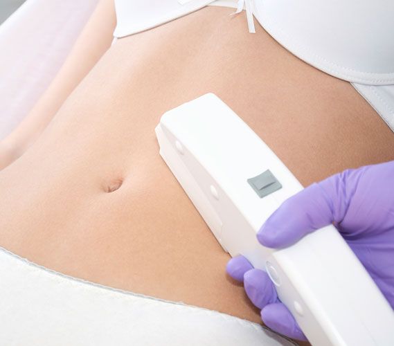 Medium-strength lasers