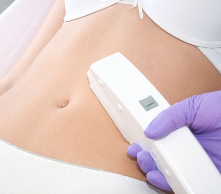 Medium-strength lasers