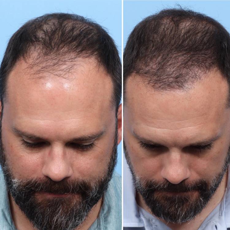 Wayne, NJ facial plastic surgeon Jeffrey B. Wise, MD