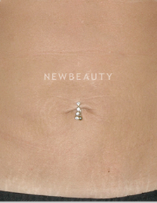 Dr. Ruth Hillelson Skin Resurfacing - After