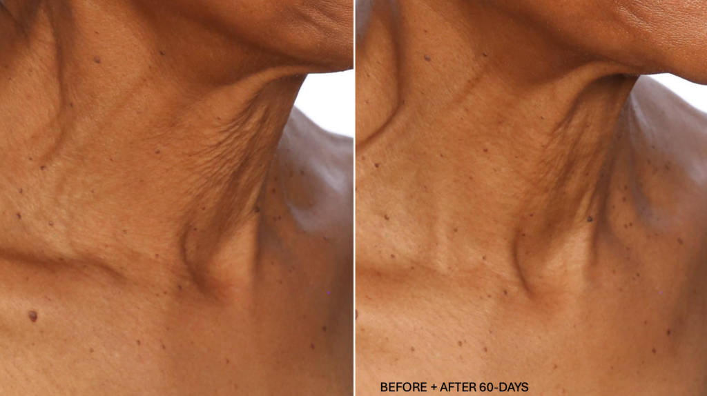 U Beauty Neck Concentrate