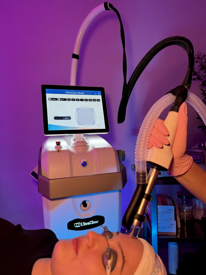 Acclaro Medical UltraClear Laser