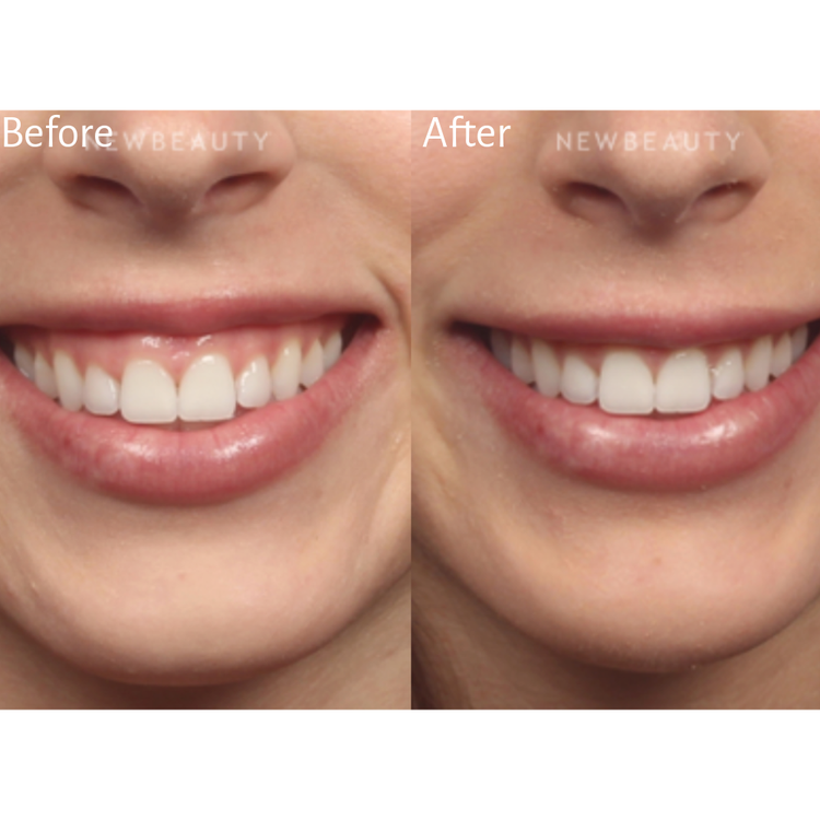 Smile More
