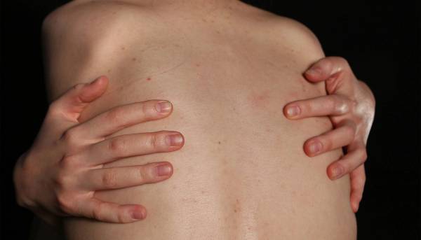 Woman itching her back skin