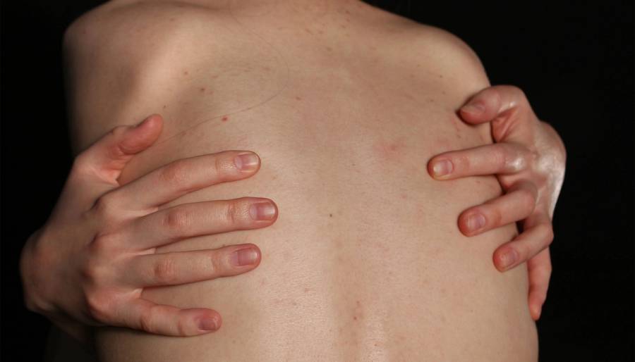 Woman itching her back skin
