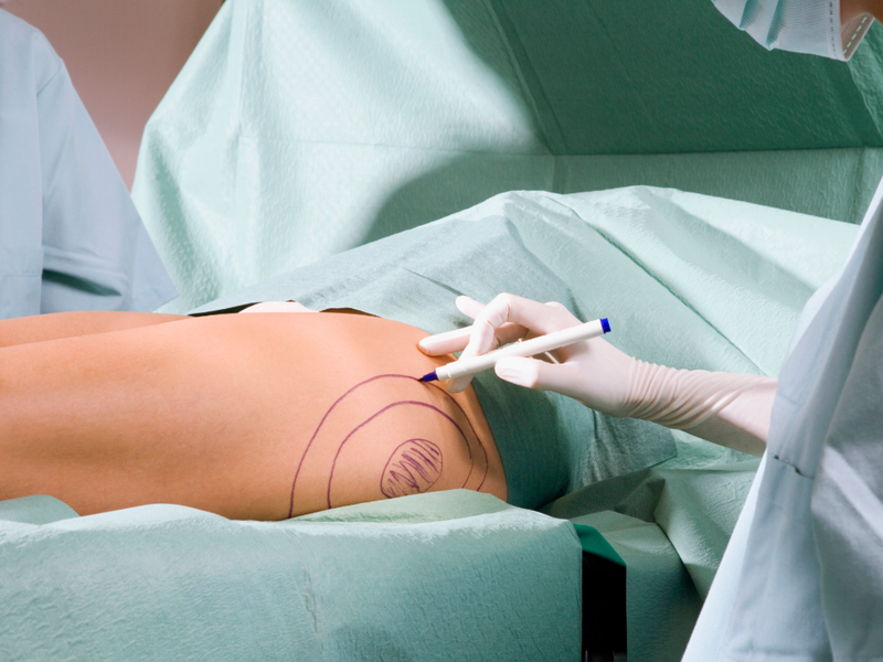 How to Know When Real Surgery Is the Answer