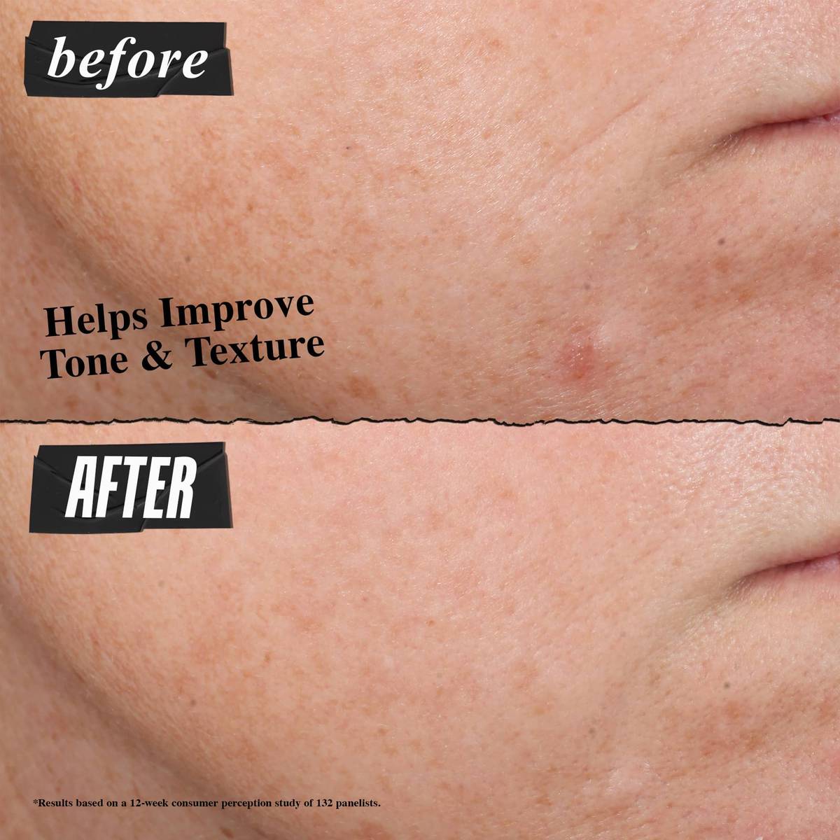 This Two-Step Serum Combo Is Bringing My Dull Skin Back to Life