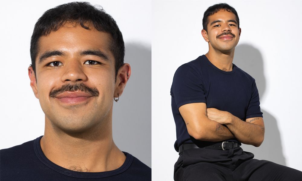 Wally Montes de Oca hair restoration