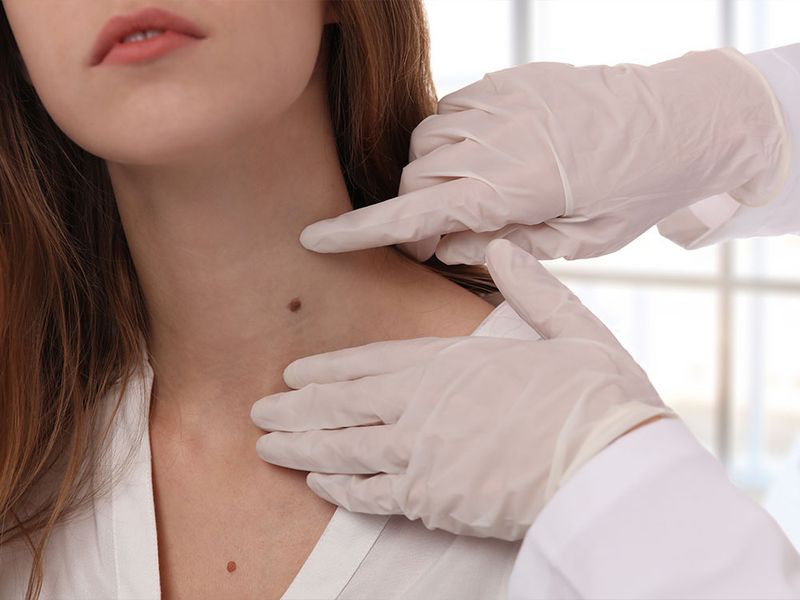 9 Questions to Always Ask at Your Annual Dermatologist Appointment