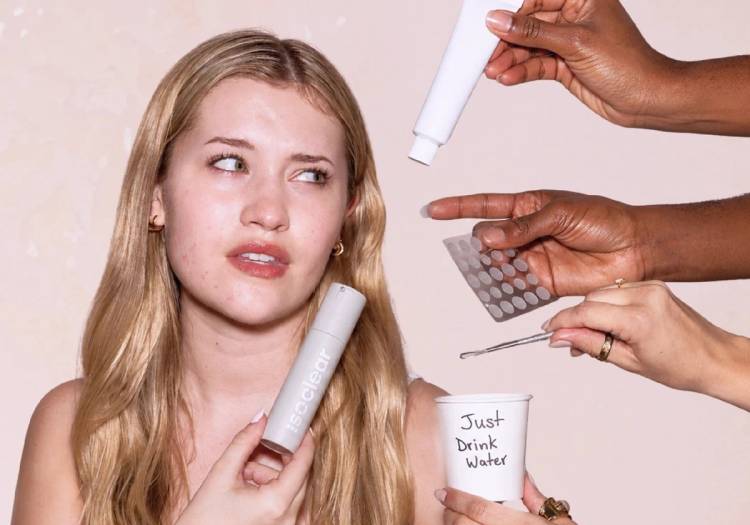 A woman with acne holds an Isoclear product while hands offer her unsolicited acne advice, including pills, a cream tube, a bobby pin and a cup labeled 'Just Drink Water'