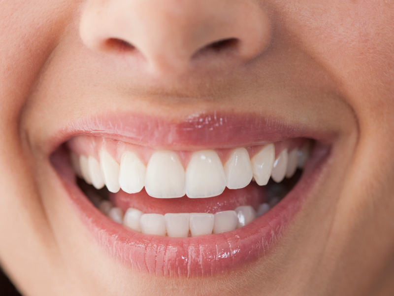 Unlocking Your Ultimate Accessory: The Power of Your Smile