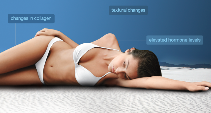 why Stretchmarks Occur Newbeauty