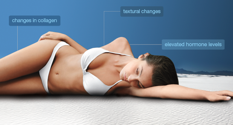 why Stretchmarks Occur Newbeauty