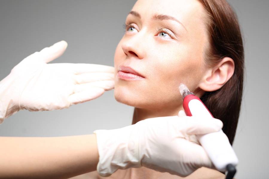 badmicroneedling