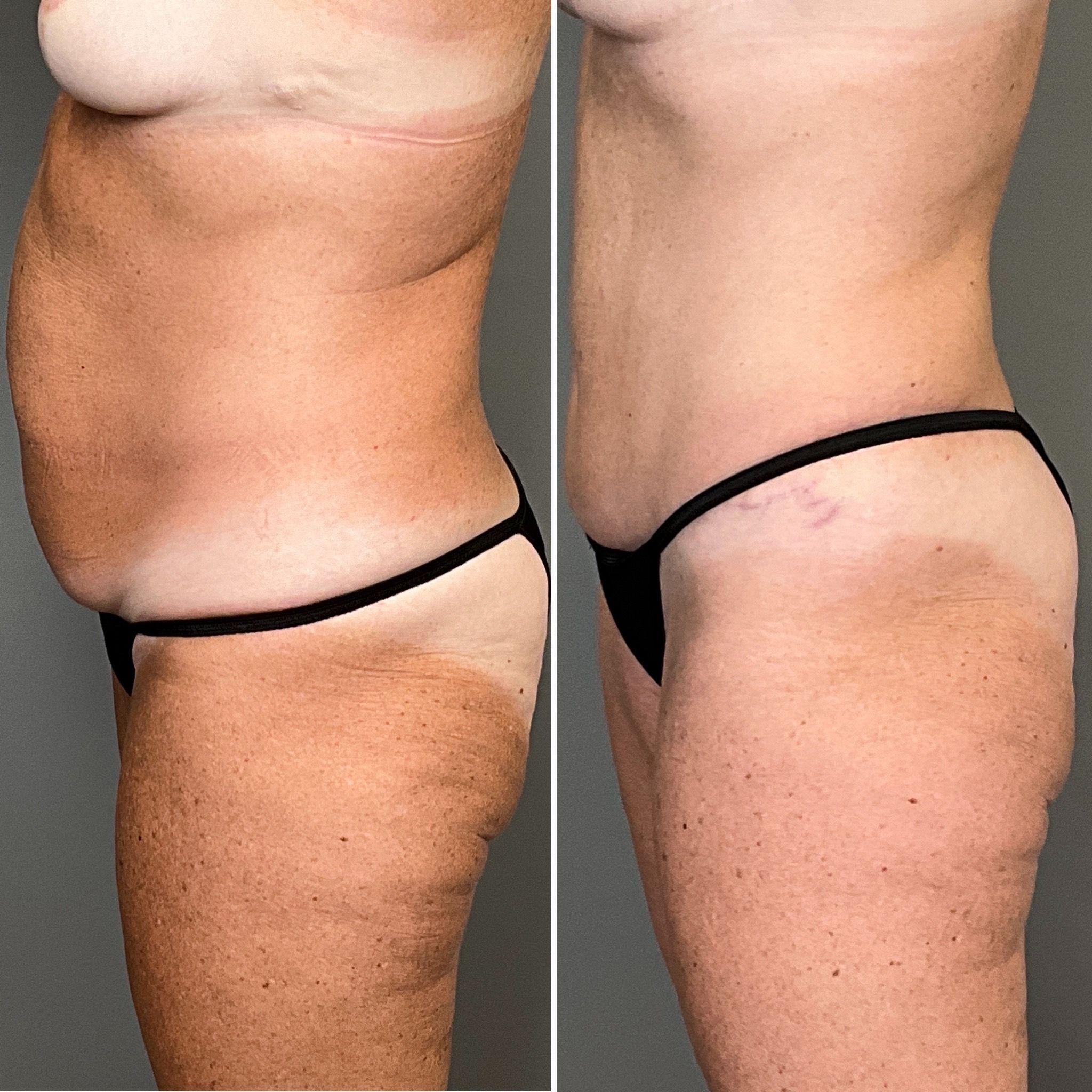 Louisville, KY plastic surgeon Chet Mays, MD