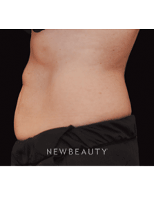 Dr. Janet Allenby, Fat Melters - After