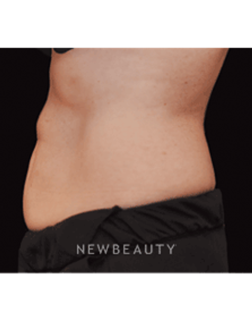 Dr. Janet Allenby, Fat Melters - After