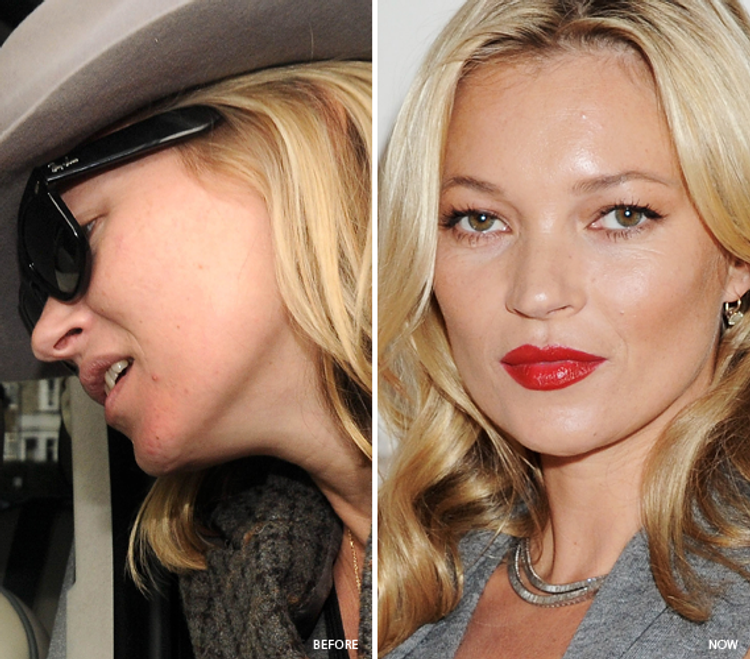 Kate Moss