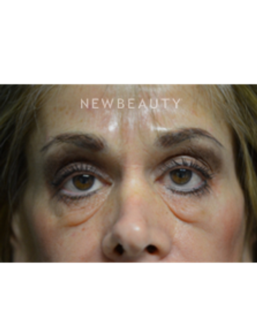 Dr. B. Aviva Preminger - A Bright New Look - Before