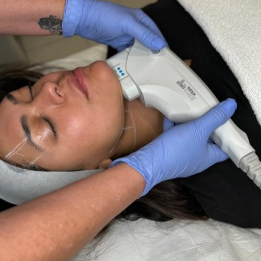 Merz Ultherapy PRIME