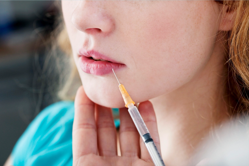 lower face getting lip filler