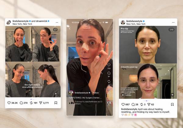 Three Instagram screenshots from Lindsi Lanestyle’s facelift journey are arranged in a row on a neutral editorial background, showing pre-op, recovery and two-month post-op moments.