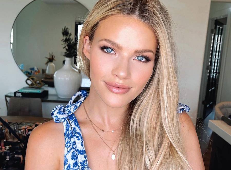 ‘Dancing With The Stars’ Witney Carson Shares Her Shocking Skin Cancer Story