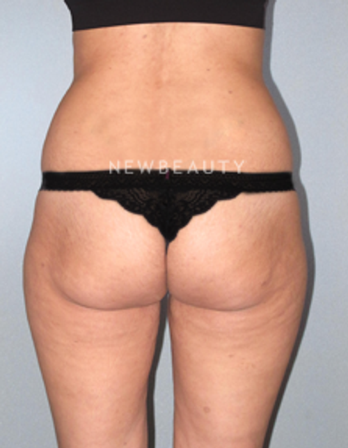 Dr. German Newall - Dramatic Transformation - Before