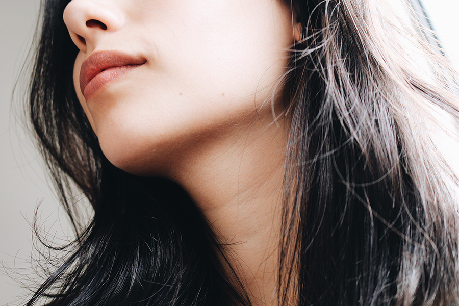 microneedling