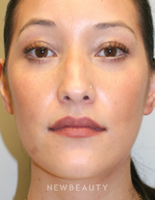 Dr. Jill Hessler - A Youthful Outlook - After